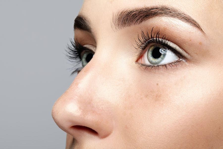 Rinoplastia