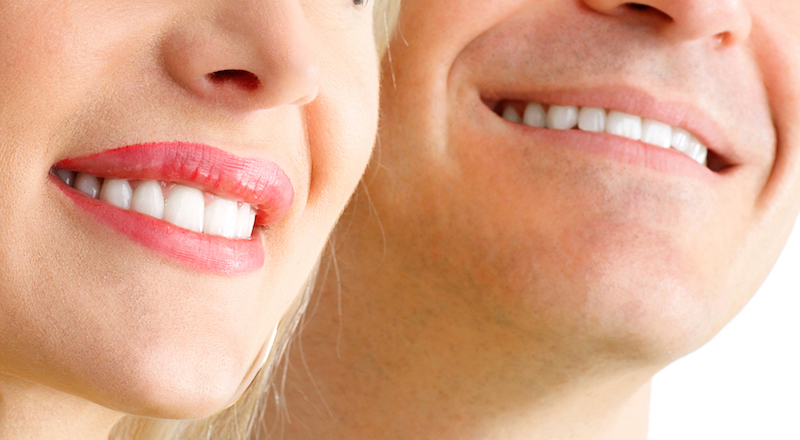 Blanqueamiento De Los Dientes