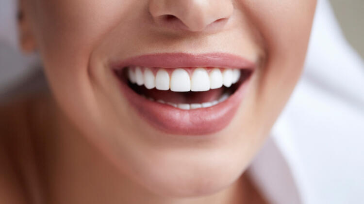 Diseño De Sonrisas