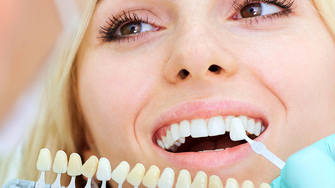 Blanqueamiento De Los Dientes