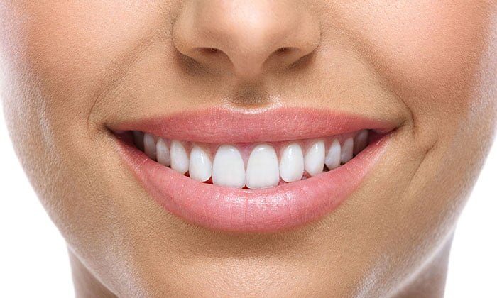 الأطراف الصناعية للأسنان