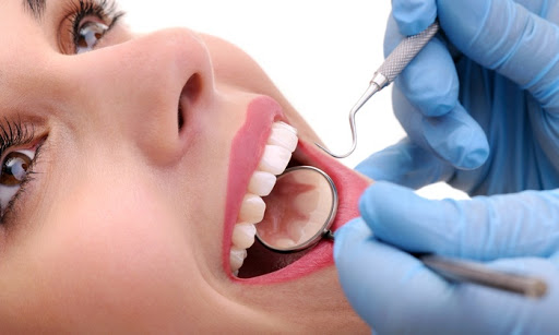 Los Implantes Dentales