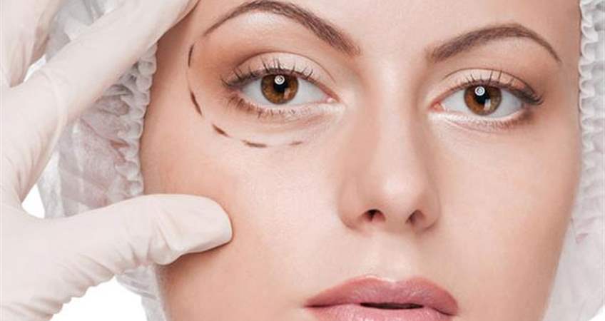 Tratamiento Del Área De Los Ojos (Oculoplastía)