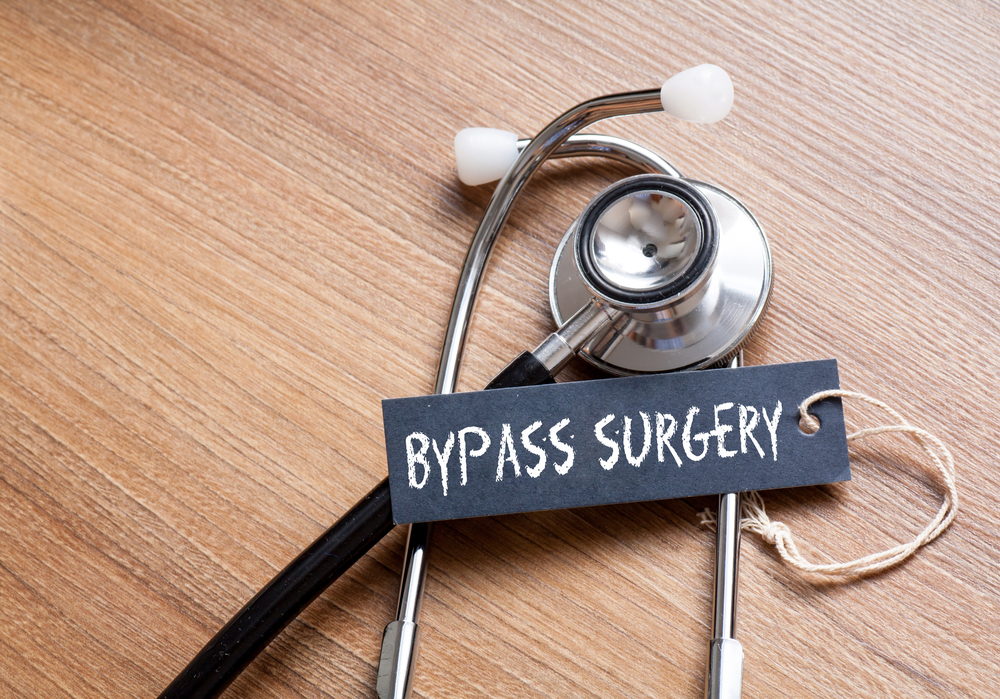 Bypass estomacal (Roux-En-Y Gastric Bypass)