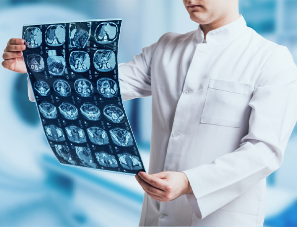 ONCOLOGÍA