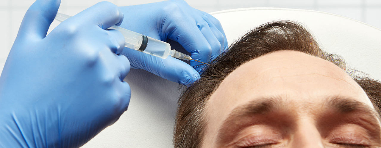 Tratamiento Capilar De Prp - Mesoterapia Capilar