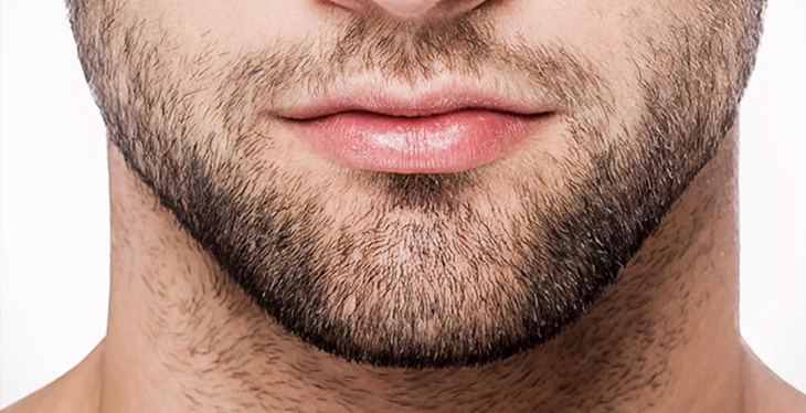 Transplante De Cejas, De Barba Y Bigote