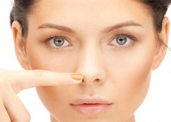 Rinoplastia