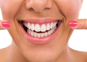 Diseño De Sonrisas