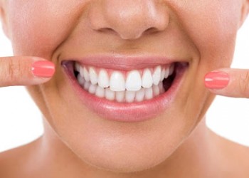 Smile Design