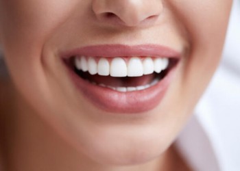 Los Implantes Dentales