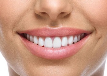 Gingival Aesthetics