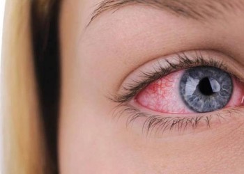 Glocom (Presión Ocular)