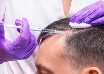 Haartransplantation Ohne Rasur