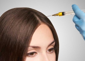 Tratamiento Capilar De Prp - Mesoterapia Capilar